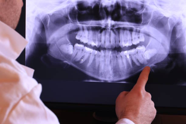 Best Emergency Care for Gum Disease in Medina, TX